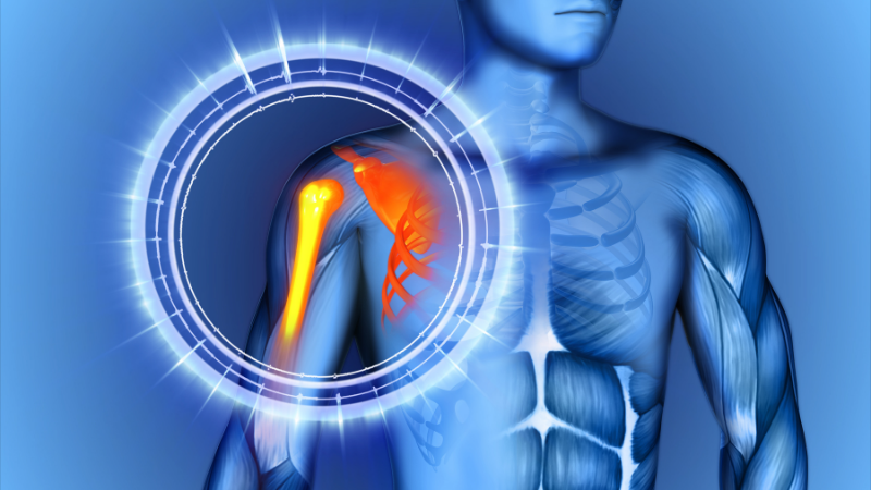 Omzum Sakatlandı: Ne Yapmalıyım, Nasıl İyileşir?